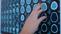 Doctors hand pointing at the brain photo